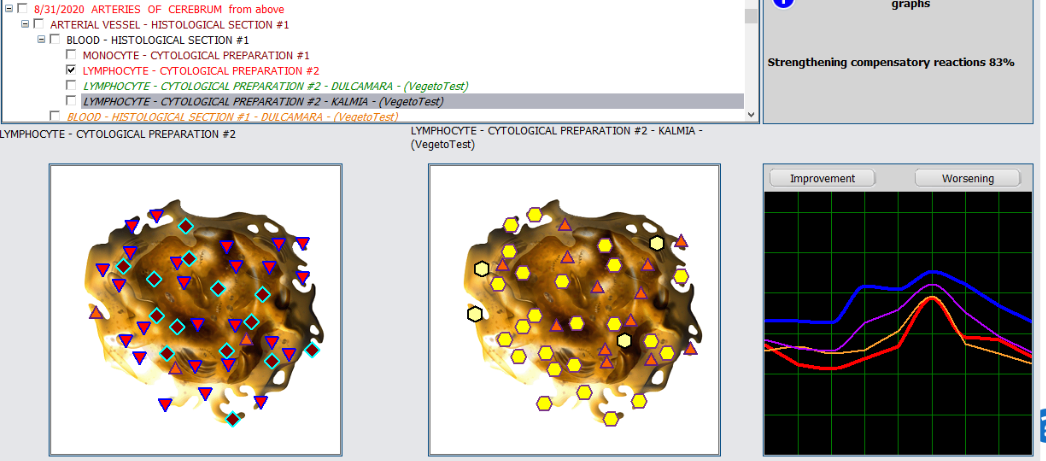 Lymphocyte comparison